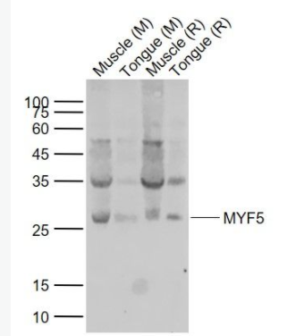 MYF5 生肌决定因子Myf5抗体