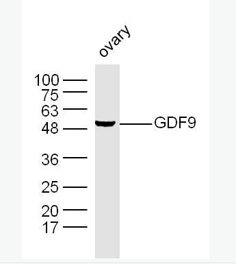 GDF9 生长分化因子9抗体