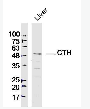 CTH 胱硫醚γ裂解酶抗体
