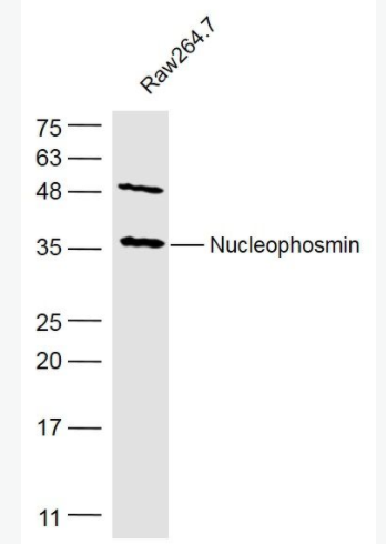 Nucleophosmin 核仁磷酸蛋白抗体