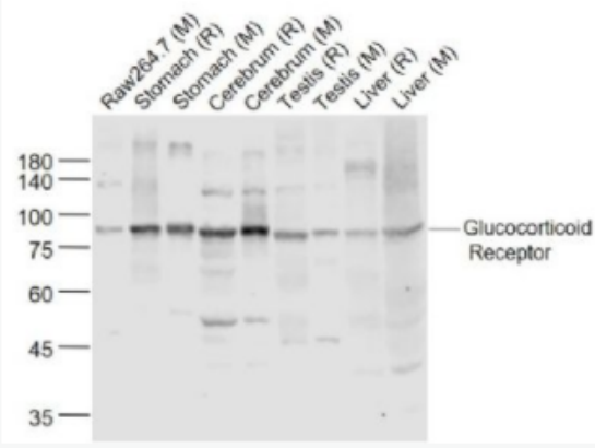 Glucocorticoid Receptor 糖皮质激素受体(β)抗体