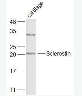 Sclerostin 骨形态发生抑制蛋白SOST抗体