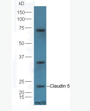 Claudin 5 紧密连接蛋白5抗体