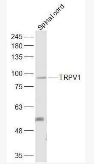 TRPV1 辣椒素受体抗体