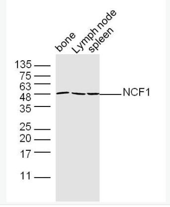 NCF1 嗜中性粒细胞胞浆因子1抗体