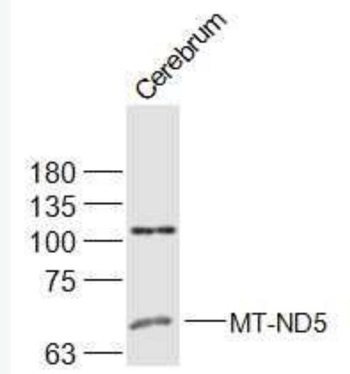MT-ND5 NADH复合体5抗体