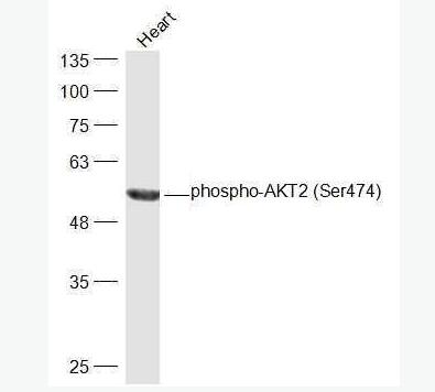 phospho-AKT2 (Ser474)  磷酸化蛋白激酶B2抗体
