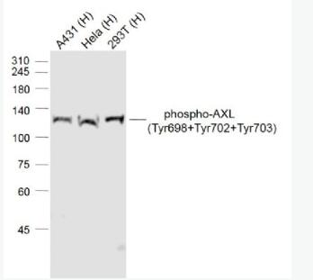 phospho-AXL (Tyr698+Tyr702+Tyr703) 磷酸化粘附相关激酶抗体