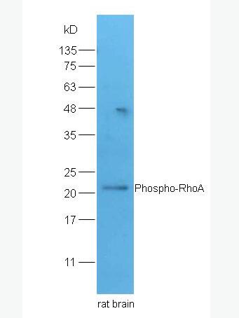 Phospho-RhoA (Ser188) 磷酸化RhoA蛋白抗体