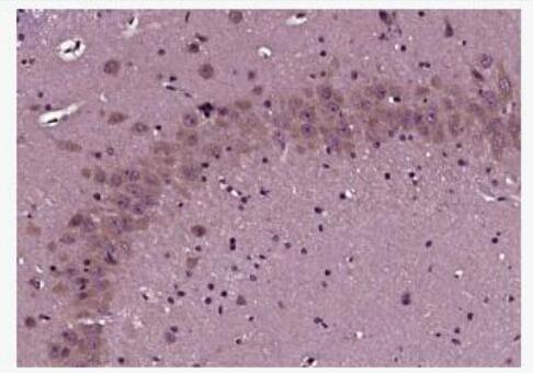 Neurokin B receptor 神经激肽B受体抗体