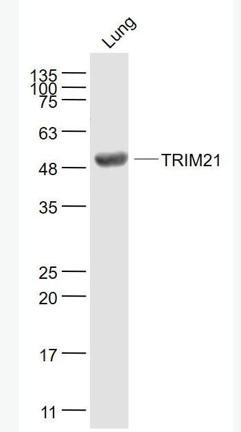 TRIM21 核糖核蛋白自身抗原抗体