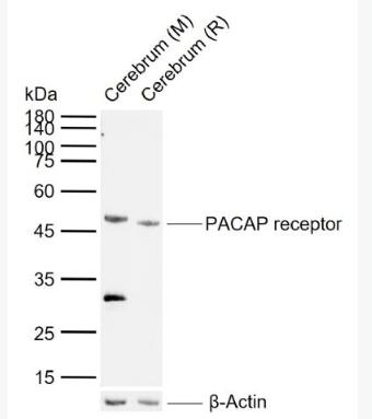 PACAP receptor 腺苷酸环化酶激活肽受体1抗体