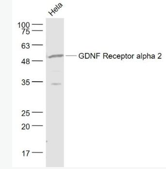 GDNF Receptor alpha 2 胶质细胞系源性神经营养因子受体α2抗体