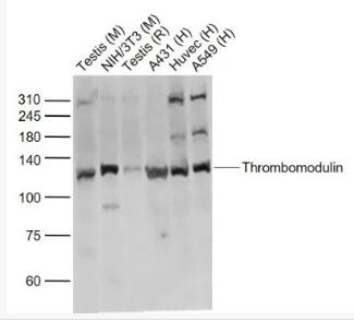 Thrombomodulin 血栓调节蛋白抗体