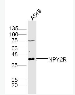 NPY2R 神经肽Y受体2抗体