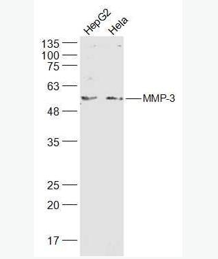 MMP3  基质金属蛋白酶3抗体