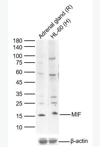 MIF 巨噬细胞移动抑制因子抗体