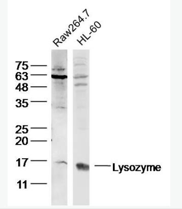 Lysozyme 溶菌酶抗体