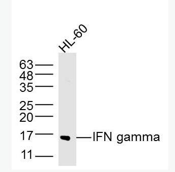 IFN gamma 干扰素-γ/IFN-γ抗体