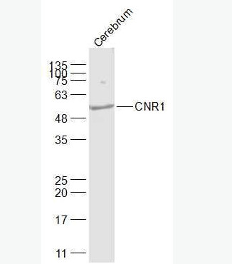 Anti-CNR1 antibody - 钙粘蛋白相关的神经受体1抗体