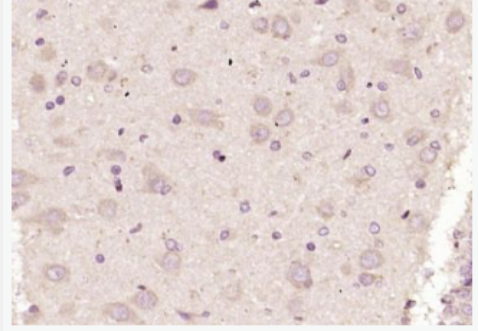 Anti-NMDAR1 antibody -离子型谷氨酸受体1抗体