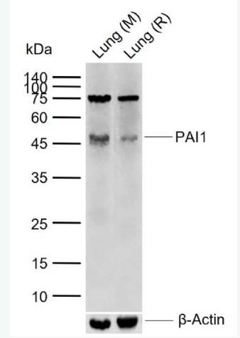 Anti-PAI1 antibody -纤溶酶原激活物抑制因子抗体