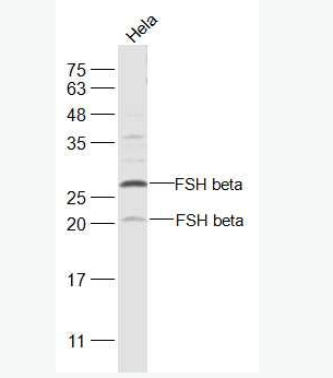 Anti-FSH beta antibody -促卵泡刺激素抗体
