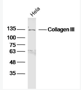 Anti-Collagen III antibody -Ⅲ型胶原蛋白/胶原蛋白3/3型胶原蛋白抗体