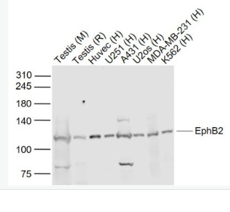 Anti-EphB2 antibody -酪氨酸蛋白激酶受体B2抗体