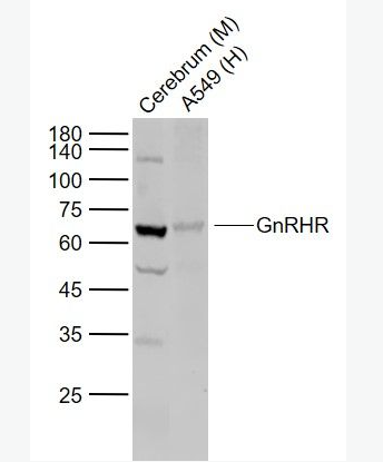 Anti-GnRHR antibody -促性腺激素释放激素受体抗体