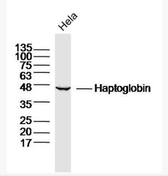 Anti-Haptoglobin antibody -结合珠蛋白/触珠蛋白抗体
