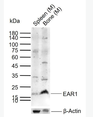 Anti-EAR1 antibody -嗜酸性粒细胞阳离子蛋白抗体