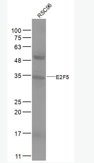 Anti-E2F5 antibody -转录因子E2F-5抗体