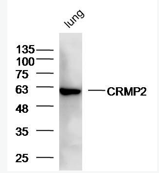 Anti-CRMP2 antibody -二氢嘧啶酶相关蛋白2(CRMP2/DPYL2)抗体