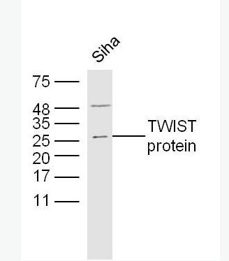 Anti-TWIST antibody -TWIST蛋白抗体