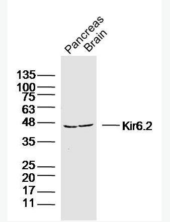 Anti-Kir6.2 antibody -ATP敏感性钾通道亚基kir6.2抗体