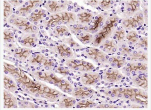 Anti-ET-1 antibody -内皮素-1抗体