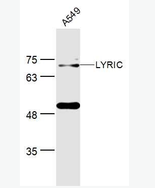 Anti-LYRIC antibody -星形胶质细胞升高基因1抗体