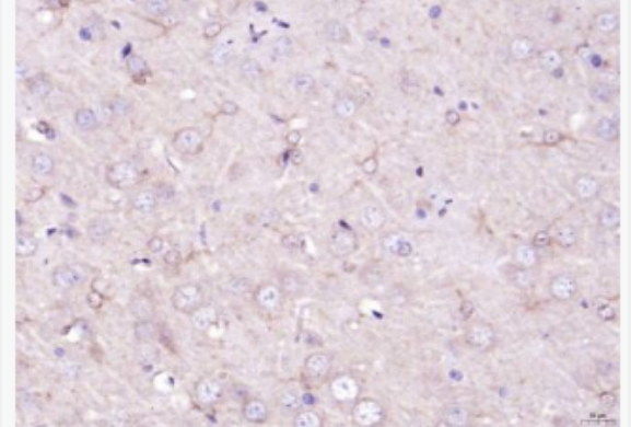 Anti-Versican antibody -蛋白聚糖Versican抗体