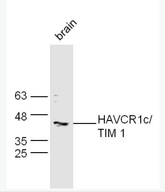 Anti-HAVCR1 antibody -肾损伤分子1/甲型肝炎病毒细胞受体1抗体