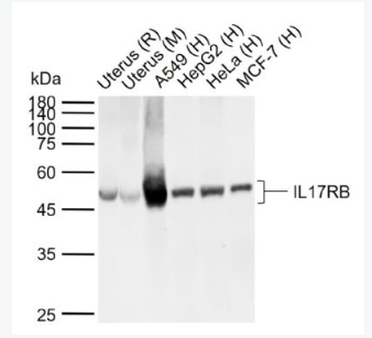 Anti-IL17RB antibody -白介素-17B受体抗体