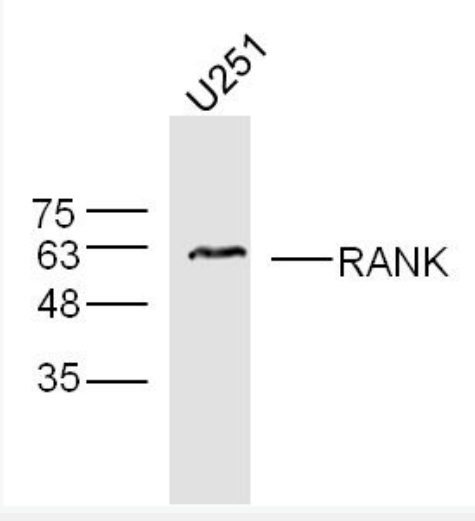 Anti-RANK antibody -核转录因子NF-κB受体抗体(核因子kB受体活化因子)