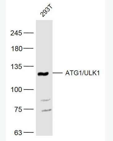 Anti-ATG1/ULK1 antibody -自噬相关蛋白1抗体