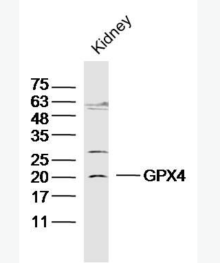 Anti-GPX4 antibody -中文名称谷胱甘肽过氧化酶4抗体