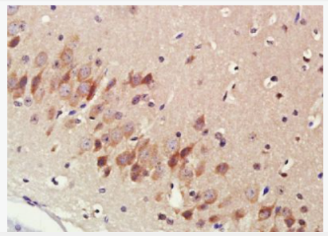 Anti-Cytochrome P450 17A1 antibody -细胞色素P450 17抗体