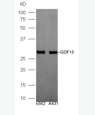 Anti-GDF15 antibody -生长分化因子15/巨嗜细胞抑制因子1抗体