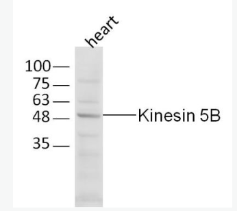 Anti-Kinesin 5B antibody -驱动蛋白KIF5B抗体