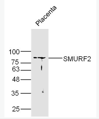 Anti-SMURF2 antibody -Smad蛋白E3泛素连接酶2抗体