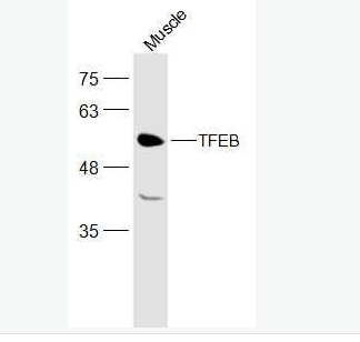 Anti-TFEB antibody -T淋巴细胞转录调节因子TFEB抗体