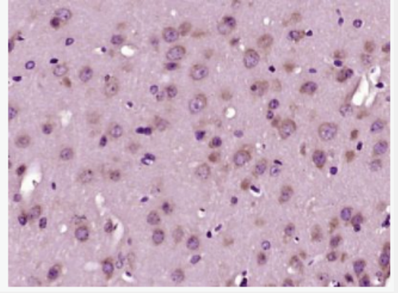 Anti-HMGCR antibody -三羟基三甲基辅酶A还原酶抗体